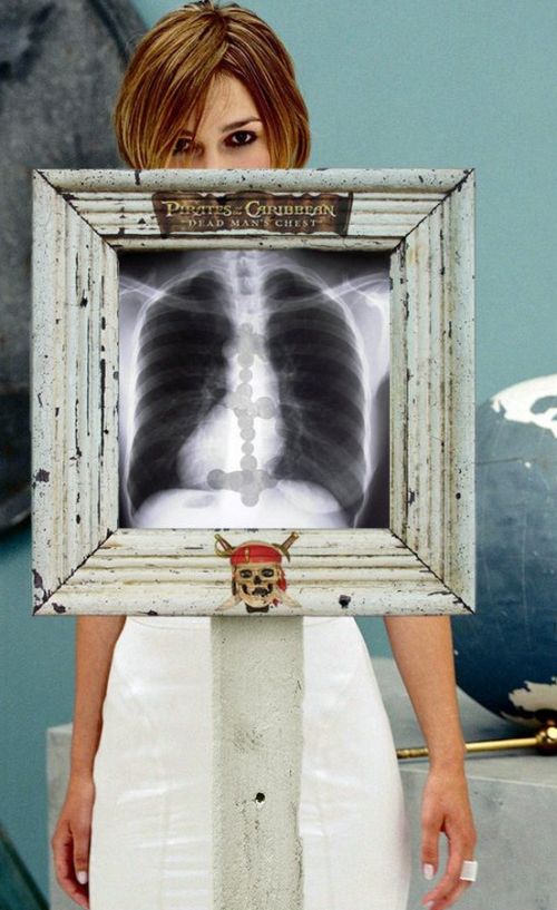 Самые смешные рентгеновские снимки