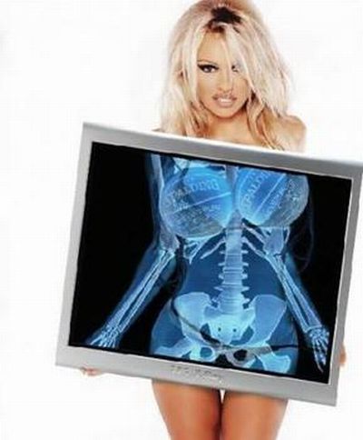 Funny X-Ray 6 Самые смешные рентгеновские снимки
